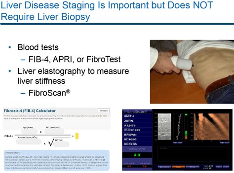 bad fibroscan results|Understanding Your Liver Elastography (FibroScan®) .
